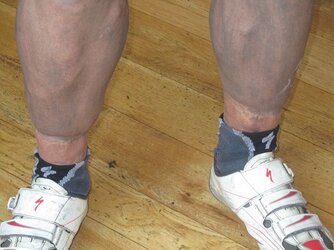 Teefs awesome pins cleaner below than above the ankle.jpg