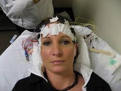 24 hour eeg.jpg