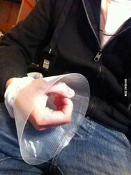 cone of shame.jpg