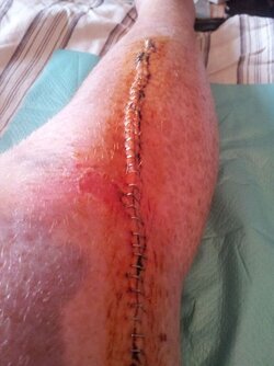 scar.jpg