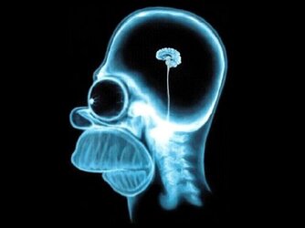 homer-small-brain-xray.jpg