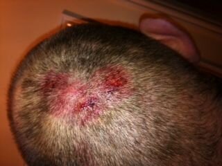 Back of head.jpg