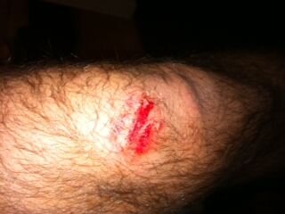 Roadrash - Knee.jpg