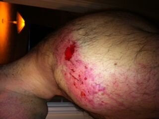 Roadrash - Shoulder.jpg