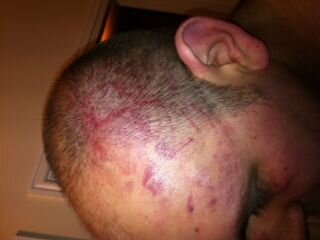 Side of head.jpg