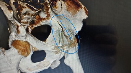 Pelvis3.jpg